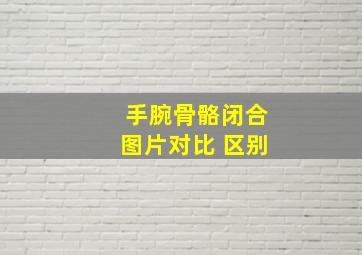 手腕骨骼闭合图片对比 区别